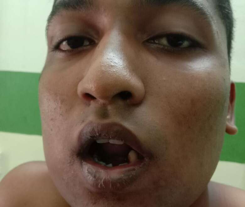 Inborn Jaw growth deformity and Post-traumatic jaw disorders